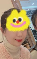 体验前-万州华美紫馨整形美容医院