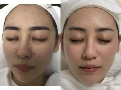 -康美贞·痘肌养护管理中心