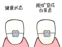 -团圆口腔·种植中心(锦江院区)