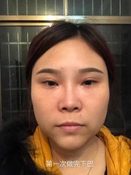 -新雅韩整形美容医院
