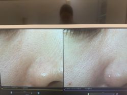 -苑苑vbeauty科技美容SPA
