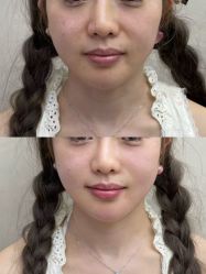 -Yestar艺星整形美容医院