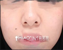 -韩国淼美颜皮肤管理官方直营店