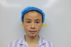 -深圳悦她医疗美容