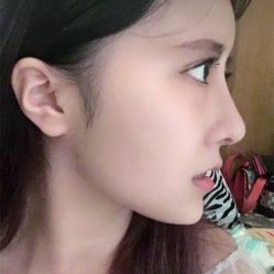 点击看大图 体验后-烟台曙光医疗美容医院