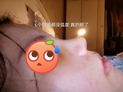 点击看大图 -Yestar宁波艺星整形医院