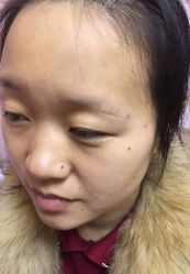 -MUSES专业脱毛比基尼サロン日式连锁