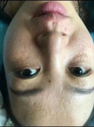 -美丽人生祛斑扁平疣汗管瘤中心
