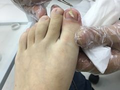 -新甲连锁灰指甲·甲沟炎·鸡眼(黑龙江路店)