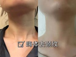 -上海漾颜医疗美容