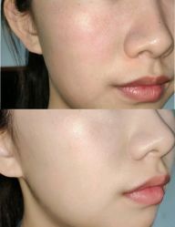 -苗方清颜痘肌研究所