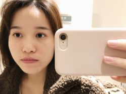 -美丽人生祛斑扁平疣汗管瘤中心