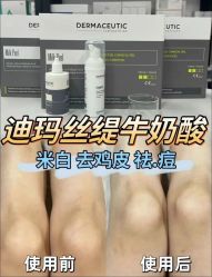 -VE专注问题肌·赛诺龙&科学美肤中心