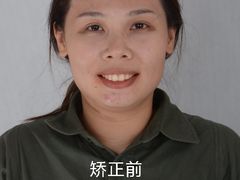 -柏乐口腔(南宁总院)