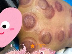 -上海德众堂中医门诊部·骨伤·推拿·针灸