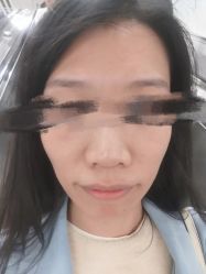 体验后-海峡医疗美容医院