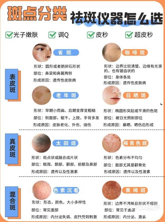 日晒斑是怎么形成的图片