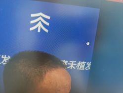 -雍禾植发全国连锁