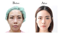 -SKINIST丽铂医疗美容