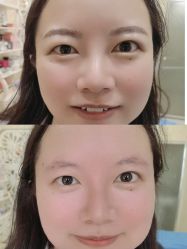 点击看大图 -西施无菌半永久纹绣眉眼影唇轻增发纹发际线