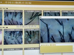-丝客富脱发养发头皮馆