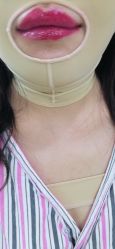-西安壹加壹医疗美容·西北抗衰旗舰店