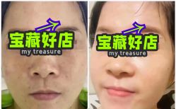点击看大图 -玫莉蔻皮肤管理中心