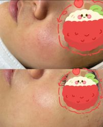 -skin79皮肤管理中心