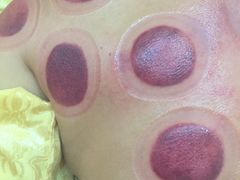 -钱氏艾灸堂(云峰街店)