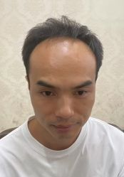 -唐风采假发补发定制
