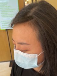 -四川米兰柏羽医学美容医院