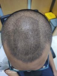 点击看大图 -雍禾植发全国连锁