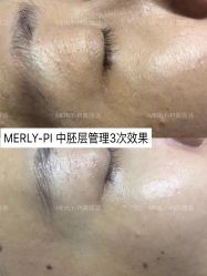 -MLP美丽派·问题肌疗愈中心