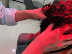 -雍禾植发全国连锁