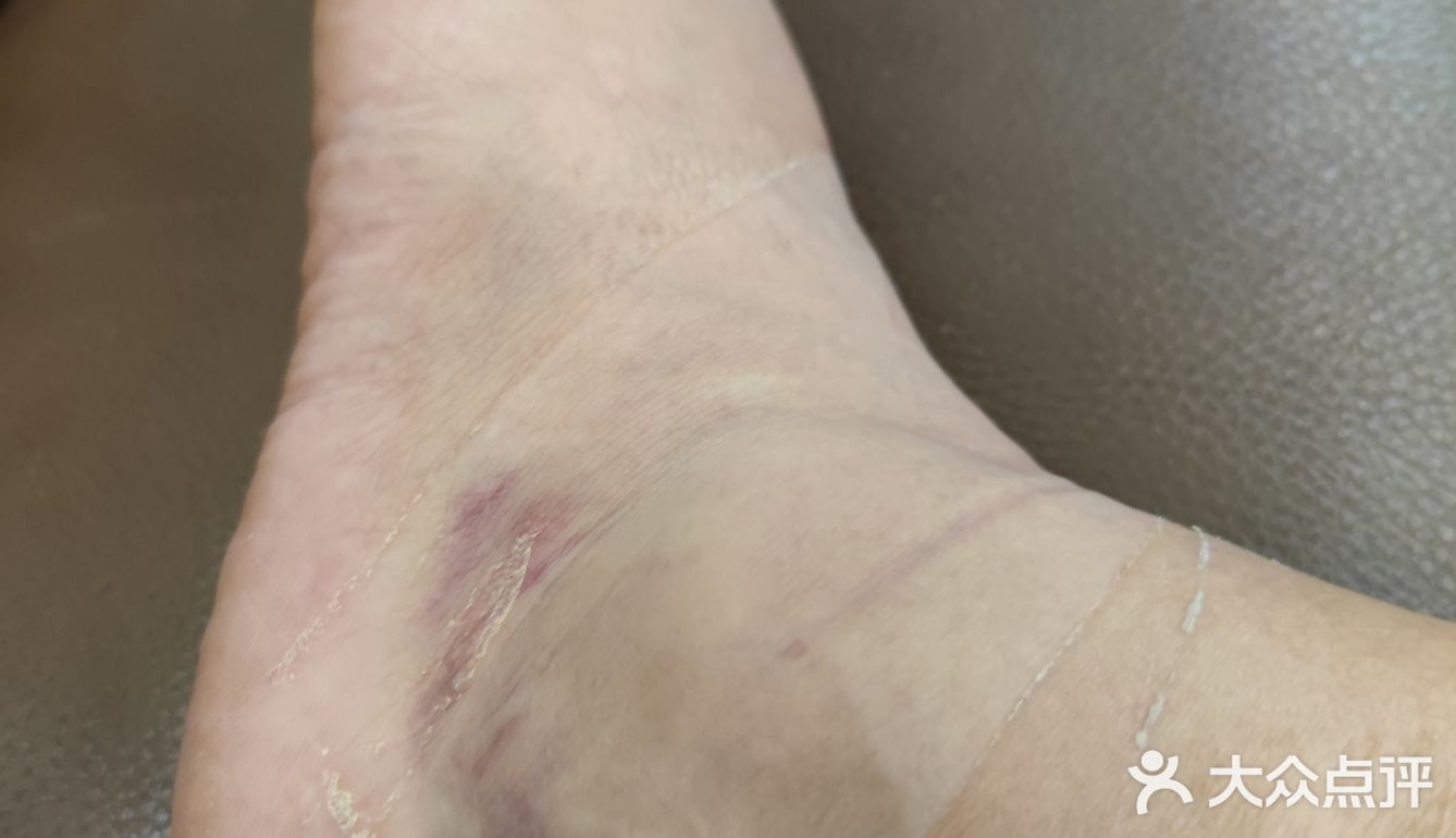 长这么大第一次遇到如此差劲差劲👎🏻👎🏻👎🏻👎的