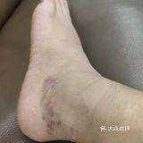 长这么大第一次遇到如此差劲差劲👎🏻👎🏻👎🏻👎的