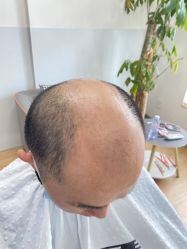 -发饰美男士增发补发假发定制店