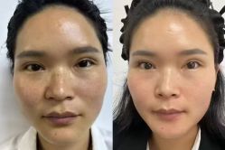 -星港国际·Skin皮肤专研·皮肤管理