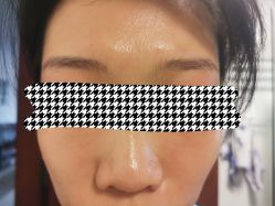 体验后-美莱医疗美容医院