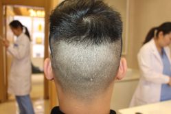 -大麦微针植发丨全国连锁