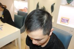 -大麦微针植发丨全国连锁