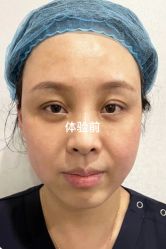 点击看大图 体验前-脸博士医疗美容·眼鼻整形·抗衰中心