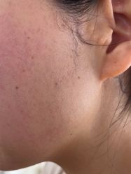 体验后-BR光电保养