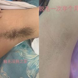 体验前-昆明梦想医疗美容医院