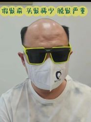 -唐风采假发补发定制