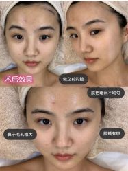 -长沙雅美医疗美容医院