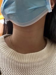 点击看大图 体验前-东莞台心医院-医疗美容