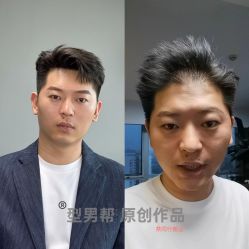 -型男帮男士假发补发·佩戴式发型