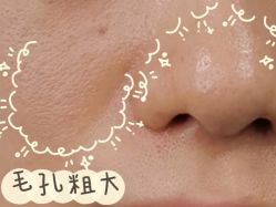 -苗方清颜痘肌研究所