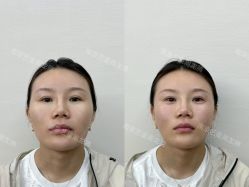 -Yestar艺星医疗美容医院